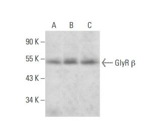GlyR &beta; Antibody (D-8) - Western Blotting - Image 297900 