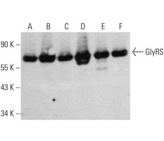 GlyRS Antibody (D-10) - Western Blotting - Image 385179 