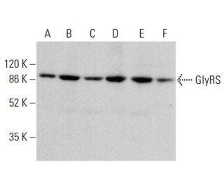 GlyRS Antibody (A-6) - Western Blotting - Image 379910