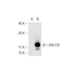 GM-CSF Antibody (NYRhGMCSF) - Western Blotting - Image 54849