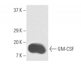 GM-CSF Antibody (B6-2-hGMCSF) - Western Blotting - Image 10105