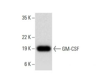 GM-CSF Antibody (H-3) - Western Blotting - Image 307999The Double Nickase Plasmid features a U6 promoter for sgRNA expression, a 20 nt targeting sequence, and a gRNA scaffold to guide Cas9n. It includes a CBh promoter for Cas9n (D10A) and puromycin resistance, GFP for transfection verification, and nuclear localization signals (NLS). The 2A peptide allows co-expression of Cas9n and Puro from a single promoter, enabling precise genome editing with reduced off-target effects. 