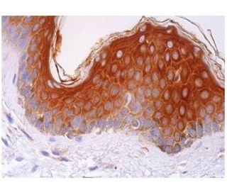 GM-CSFR&alpha; Antibody (4H1) - Immunohistochemistry - Image 293637 