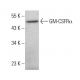 GM-CSFRα Antibody (8G6 BOT) - Western Blotting - Image 381358