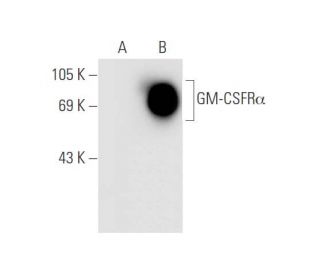 GM-CSFR&alpha; Antibody (8G6) - Western Blotting - Image 62582 