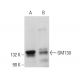 GM130 Antibody (4i375) - Western Blotting - Image 378742