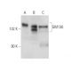 Este anticuerpo policlonal ha dejado de fabricarse. Consulta nuestro anticuerpo monoclonal recomendado <a href="gm130-antibody-h-7">GM130 (H-7)</a> (se muestran datos de muestra). western blotting image from recommended GM130 (H-7) monoclonal antibody replacement. Image 15003