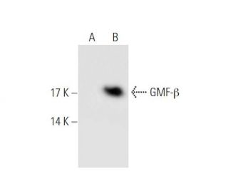 GMF-β Antibody (SP-61) - Western Blotting - Image 68593Each CRISPR/Cas9 Knockout (KO) Plasmid product consists of a pool of 3 plasmids designed to ensure identification and cleavage of a specific gene for maximum knockout efficiency. Each plasmid encodes a unique 20 nt sequence derived from the GeCKO (v2) library.