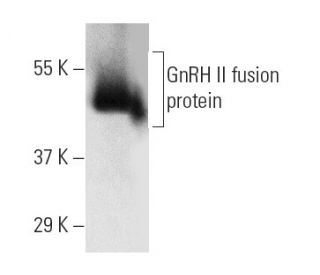GnRH II Antibody (D-9) - Western Blotting - Image 6171 