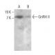 GnRH II Antibody (D-9) - Western Blotting - Image 385266