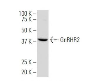 GnRHR2 Antibody (67-R) - Western Blotting - Image 33675
