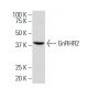 GnRHR2 Antibody (67-R) - Western Blotting - Image 33675