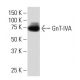 GnT-IVA Antibody (M-71) - Western Blotting - Image 34161 