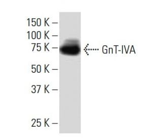 GnT-IVA Antibody (M-71) - Western Blotting - Image 34161SAM Transcription Activation: SAM system utilizing dCas9-VP64, MS2-P65-HSF1, and sgRNA for precise gene transcription activation. 