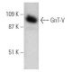 western blotting image from recommended GnT-V (3E9) monoclonal antibody replacement. Image 368260