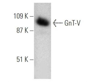 GnT-V Antibody (3E9) - Western Blotting - Image 368260
