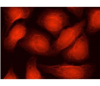SH3D19 (G-6): sc-377282. Immunofluorescence detection of SH3D19 in formalin-fixed HeLa cells showing cytoplasmic, membrane 
