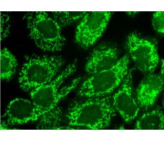 LRP130 (M-300): sc-66845. Immunofluorescence staining of formalin-fixed A-431 cells showing mitochondrial localization. De 