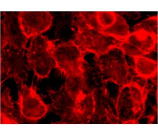 TDE2L (E-18): sc-138678. Immunofluorescence staining of formalin-fixed A-431 cells showing membrane localization. Detectio 
