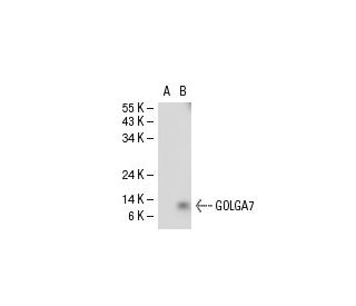 GOLGA7 Antibody (NO-2) - Western Blotting - Image 30554