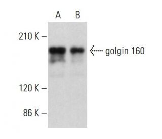golgin 160 Antibody (C-8) - Western Blotting - Image 375455The Double Nickase Plasmid features a U6 promoter for sgRNA expression, a 20 nt targeting sequence, and a gRNA scaffold to guide Cas9n. It includes a CBh promoter for Cas9n (D10A) and puromycin resistance, GFP for transfection verification, and nuclear localization signals (NLS). The 2A peptide allows co-expression of Cas9n and Puro from a single promoter, enabling precise genome editing with reduced off-target effects.