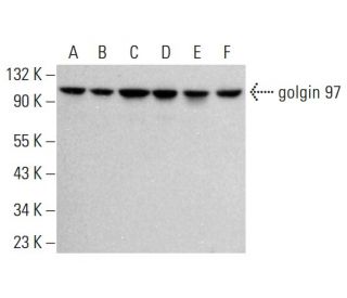 golgin 97 Antibody (CDF4) - Western Blotting - Image 380340 