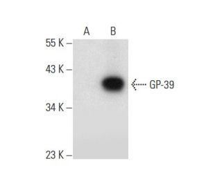 GP-39 Antibody (A-10) - Western Blotting - Image 296929 
