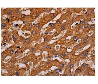 GP-39 Antibody (D-11) - Immunohistochemistry - Image 344652 