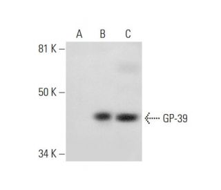GP-39 Antibody (E-10) - Western Blotting - Image 296145