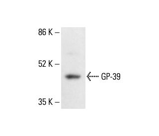 GP-39 Antibody (A-10) - Western Blotting - Image 411940