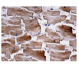 CD130/gp130 Antibody (AN-H2) - Immunohistochemistry - Image 156594 