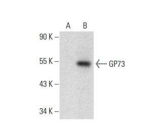 GP73 Antibody (E-7) - Western Blotting - Image 299189 