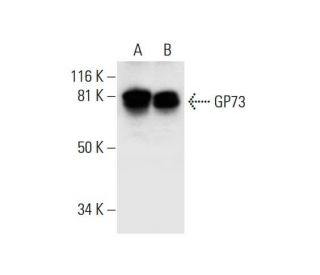 GP73 Antibody (F-2) - Western Blotting - Image 294662 