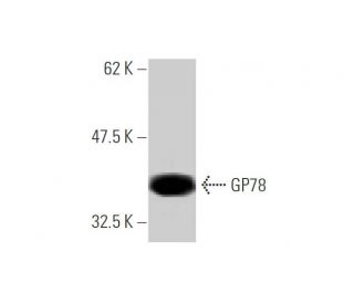 GP78 Antibody (3D9) - Western Blotting - Image 347647 