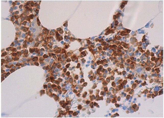 gp91phox/CYBB/NOX2 Antibody (54.1) | SCBT - Santa Cruz Biotechnology