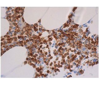 immunohistochemistry image from recommended gp91phox/CYBB/NOX2 (54.1) monoclonal antibody replacement. Image 353005