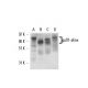 gp91phox/CYBB/NOX2 Antibody (G-1) - Western Blotting - Image 17381 
