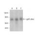 gp91phox/CYBB/NOX2 Antibody (G-1) - Western Blotting - Image 352065
