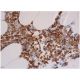 Este anticuerpo policlonal ha dejado de fabricarse. Consulta nuestro anticuerpo monoclonal recomendado <a href="gp91-phox-antibody-54-1">gp91phox/CYBB/NOX2 (54.1)</a> (se muestran datos de muestra). immunohistochemistry image from recommended gp91phox/CYBB/NOX2 (54.1) monoclonal antibody replacement. Image 353005