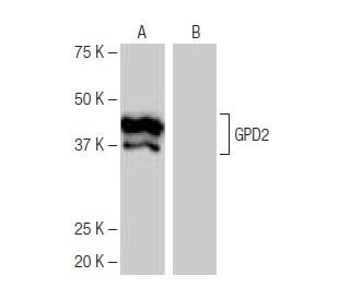 GPD2 Antibody (5-RY26) - Western Blotting - Image 64950