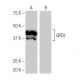 GPD2 Antibody (5-RY26) - Western Blotting - Image 64950