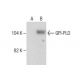 GPI-PLD Antibody (E-5) - Western Blotting - Image 281499