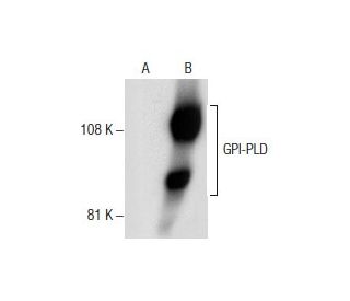GPI-PLD Antibody (E-8) - Western Blotting - Image 157570