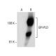 GPI-PLD Antibody (E-8) - Western Blotting - Image 157570
