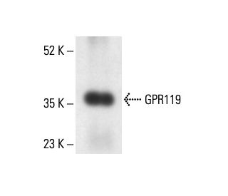 GPR119 Antibody (D-5) - Western Blotting - Image 411311 