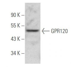 GPR120 Antibody (H-10) - Western Blotting - Image 354816The Double Nickase Plasmid features a U6 promoter for sgRNA expression, a 20 nt targeting sequence, and a gRNA scaffold to guide Cas9n. It includes a CBh promoter for Cas9n (D10A) and puromycin resistance, GFP for transfection verification, and nuclear localization signals (NLS). The 2A peptide allows co-expression of Cas9n and Puro from a single promoter, enabling precise genome editing with reduced off-target effects.