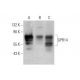 western blotting image from recommended GPR14 (D-4) monoclonal antibody replacement. Image 351668