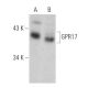 GPR17 Antibody (A-10) - Western Blotting - Image 359917 