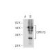 GPR175 Antibody (6H2) - Western Blotting - Image 125720