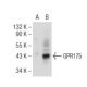 GPR175 Antibody (6H2) - Western Blotting - Image 125722 